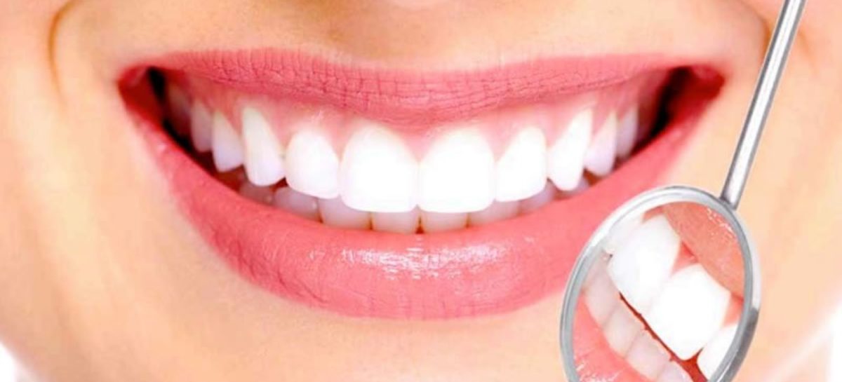 What should you know about the best teeth whitening kits
