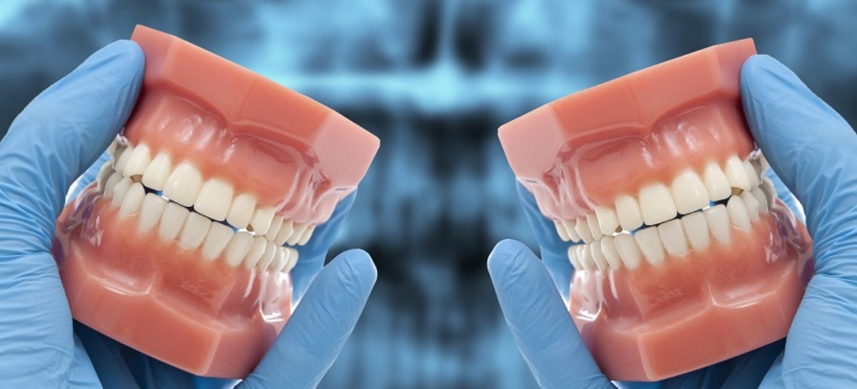 Use Of Latest Technology Resulted In More Advanced All On 4 Dental Implants