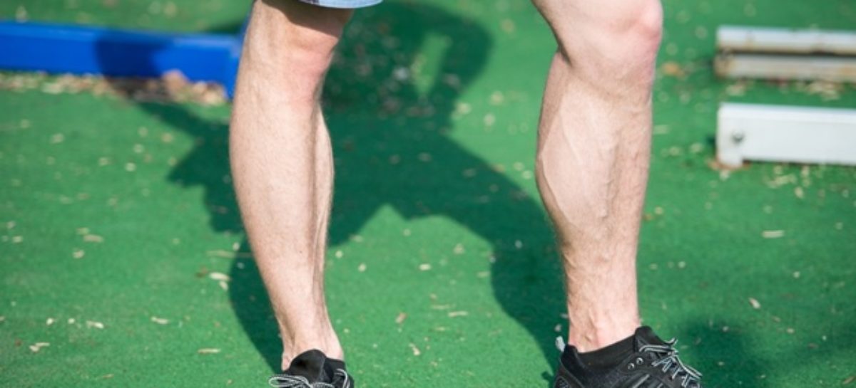 Varicose Vein Treatment: Do Hormones Play a Role In Men?