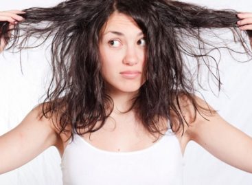 Home Remedies to Get Rid of Oily Hairs Naturally