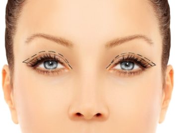 Make Yourself Look Younger With Eyelid Surgery