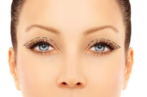 Make Yourself Look Younger With Eyelid Surgery
