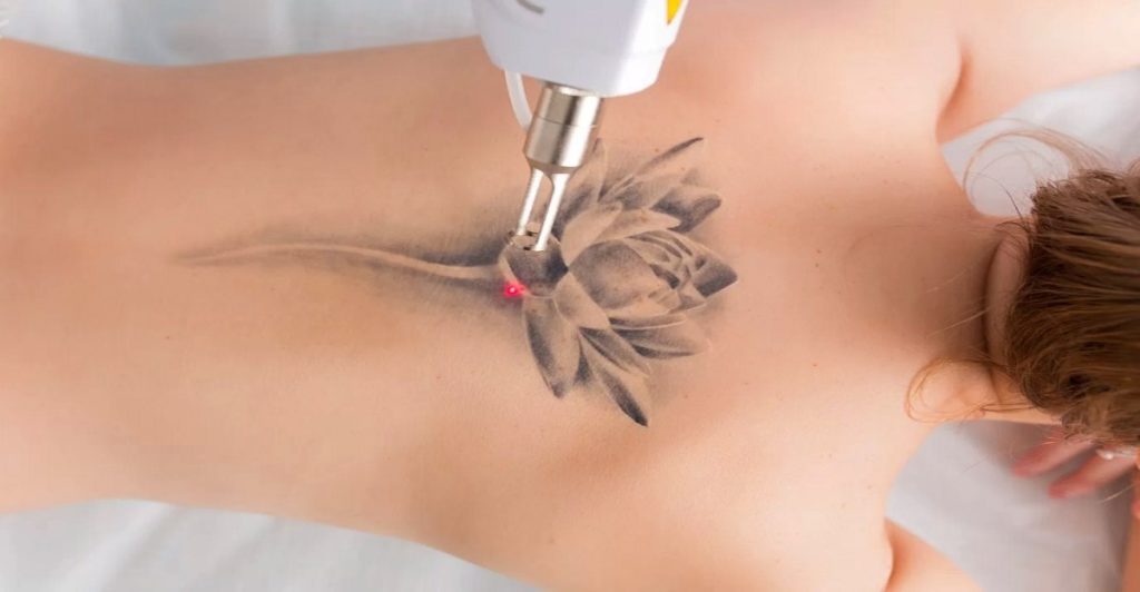 7 Interesting & Odd Facts about Laser Tattoo Removal