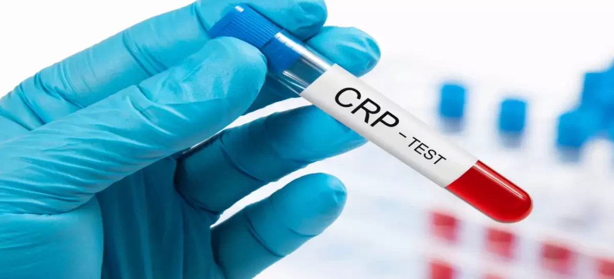 3 Steps To Book For CRP Test In Delhi