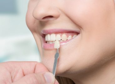 Why Do We Need Dental Veneer?