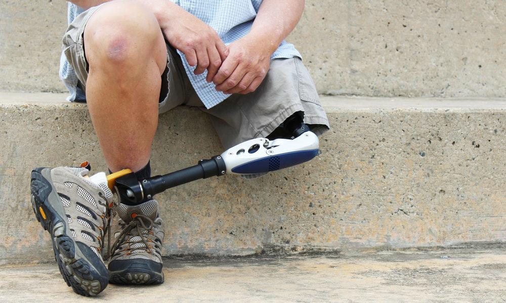 Prosthetic Care